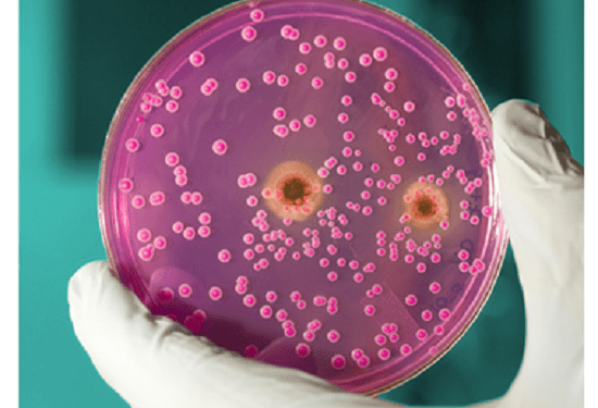 Strategic Focus on Rapid Microbiology Test Market 2019 -2025 with Key Players Like Abbott Laboratories, Inc, Alere, Inc, Bio-Rad Laboratories, Danaher Corporation, Becton, Dickinson And Company, Gen-Probe, Inc, F. Hoffman-La Roche AG