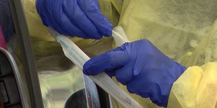 Increased struggles with coronavirus testing supply chain as cases spread like ‘wildfire’ – WAVE 3