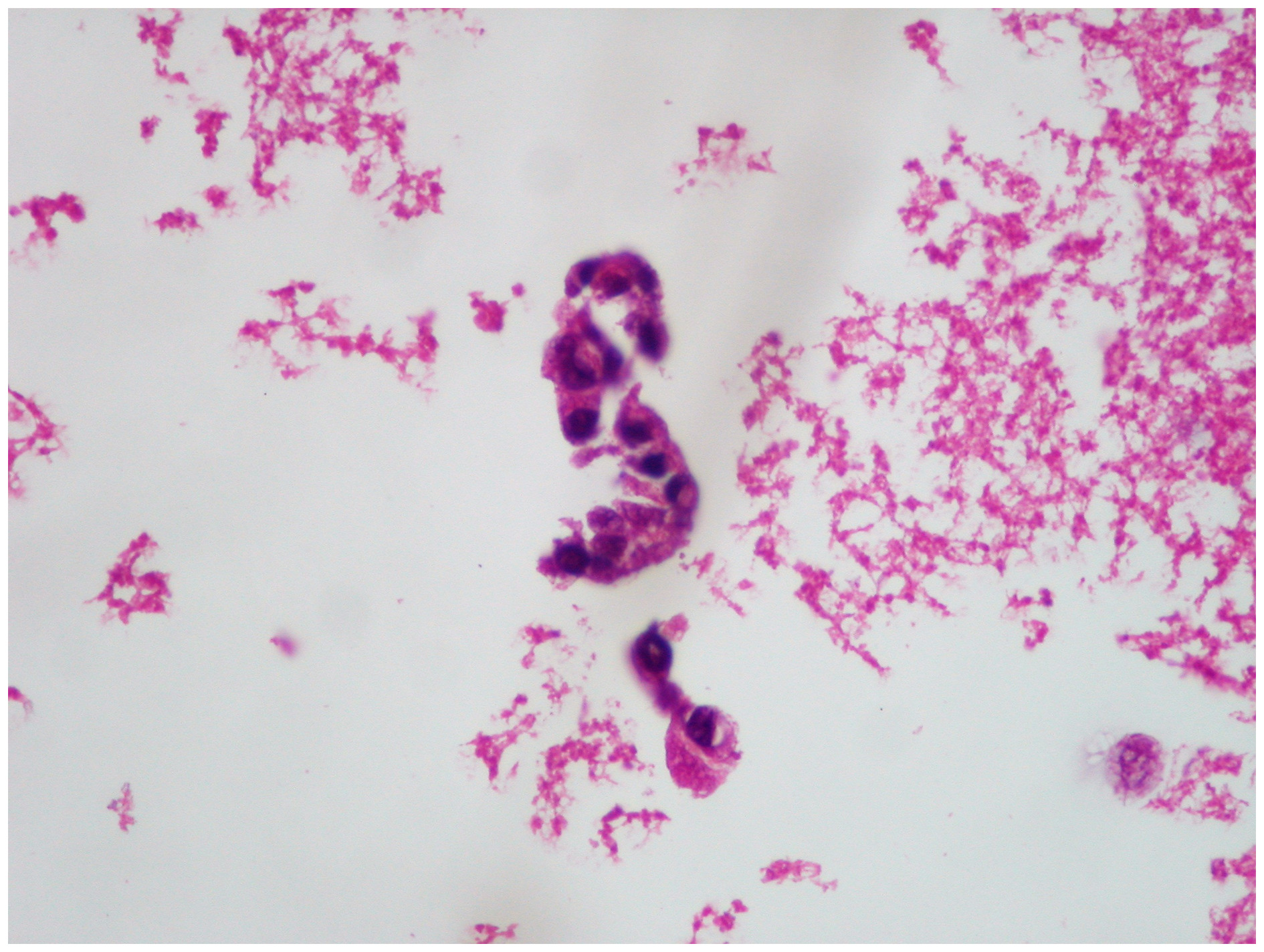 Description of a new biosafe procedure for cytological specimens from
