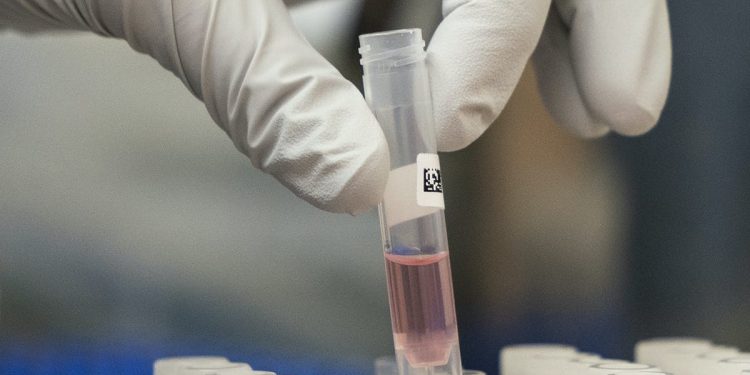 Broad COVID-19 testing under microscope