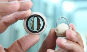 Heart Valve Market Strategic Assessment & SWOT Analysis 2021-2028 | By Application, by Product | Key Players Edwards Lifesciences, Medtronic, St. Jude Medical – KSU